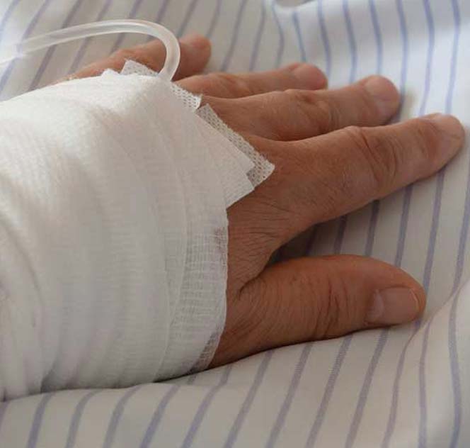 The High Costs of Burn Injuries